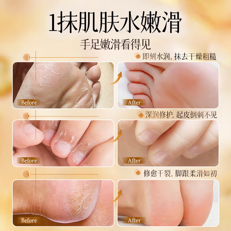 匀美博士马油护手霜留香滋润补水嫩白秋冬手部防干裂粗糙起皮男女不油腻 马油护手霜300g-2瓶