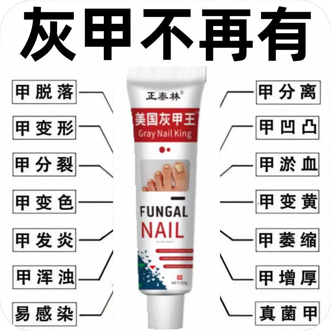 碧琢脚指头灰指甲膏灰指甲增厚严重灰指甲灰甲修复去厚甲空甲 2支