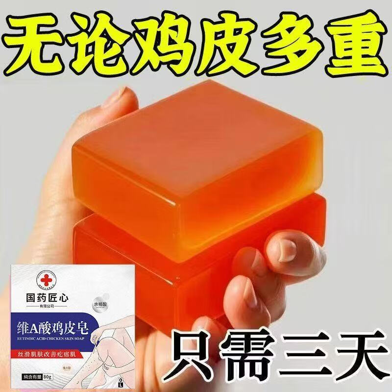 国药匠心【维A酸鸡皮皂】鸡皮鱼鳞疙瘩毛囊角化皮肤保湿手工皂 基础款【实发一盒】.光滑肌肤