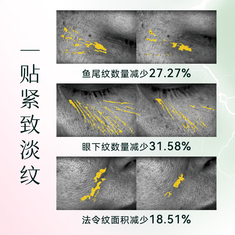 荷妮【钟丽缇同款】电子面膜仪礼盒 抗皱紧致提拉神器 面部普拉提