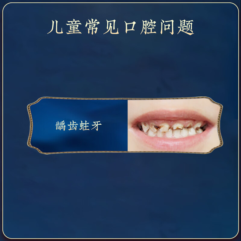 雪谷公配方牙膏儿童牙膏4-12岁含氟防蛀牙换牙期儿童专用正品 儿童配方牙膏60克3支 不支持试用