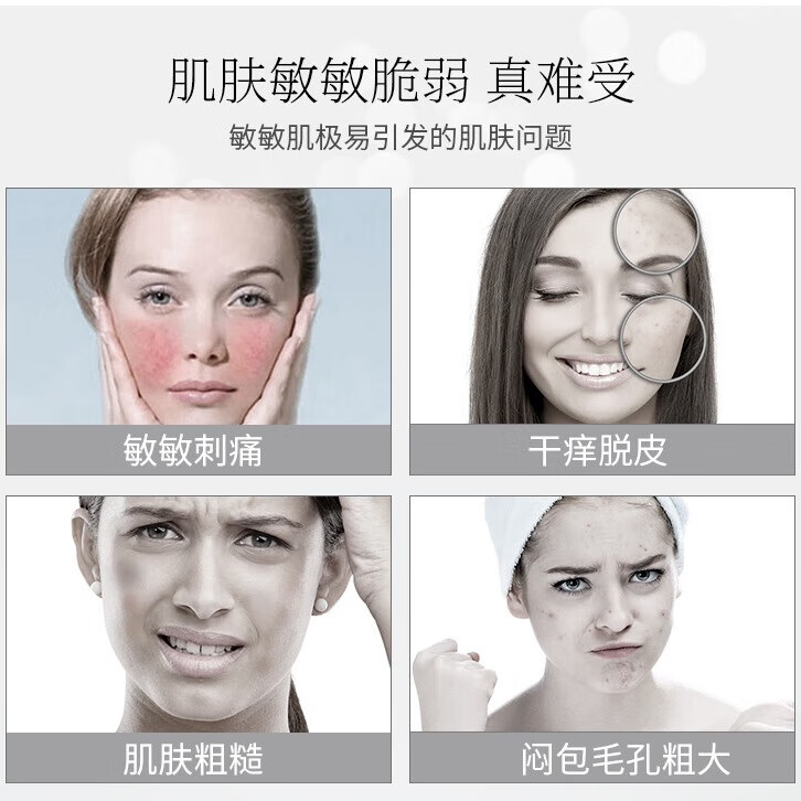 安蓓芮安蓓芮水乳套装补水保湿化妆品敏感肌修护脸部泛红护肤品套装小样 洁面+修护水+保湿乳+冻干粉