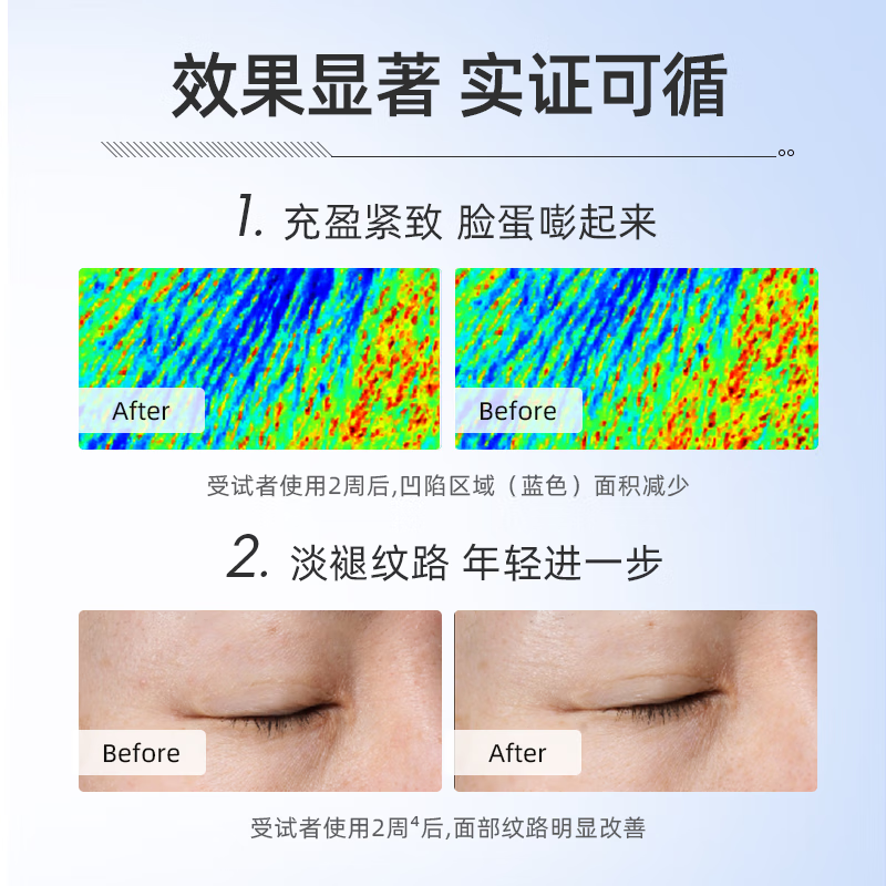 绽媄娅【活动款】贴骨Pro次抛精华液 面部抗皱紧致补水保湿 贴骨精华pro次抛50支