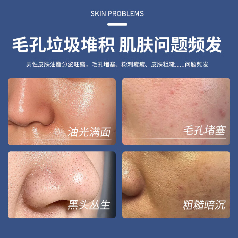 红卫火山泥羊脂皂控油净肤滋润保湿男士洗面洁面皂女士内蒙古老牌国货 【单块适用装】火山泥羊脂皂