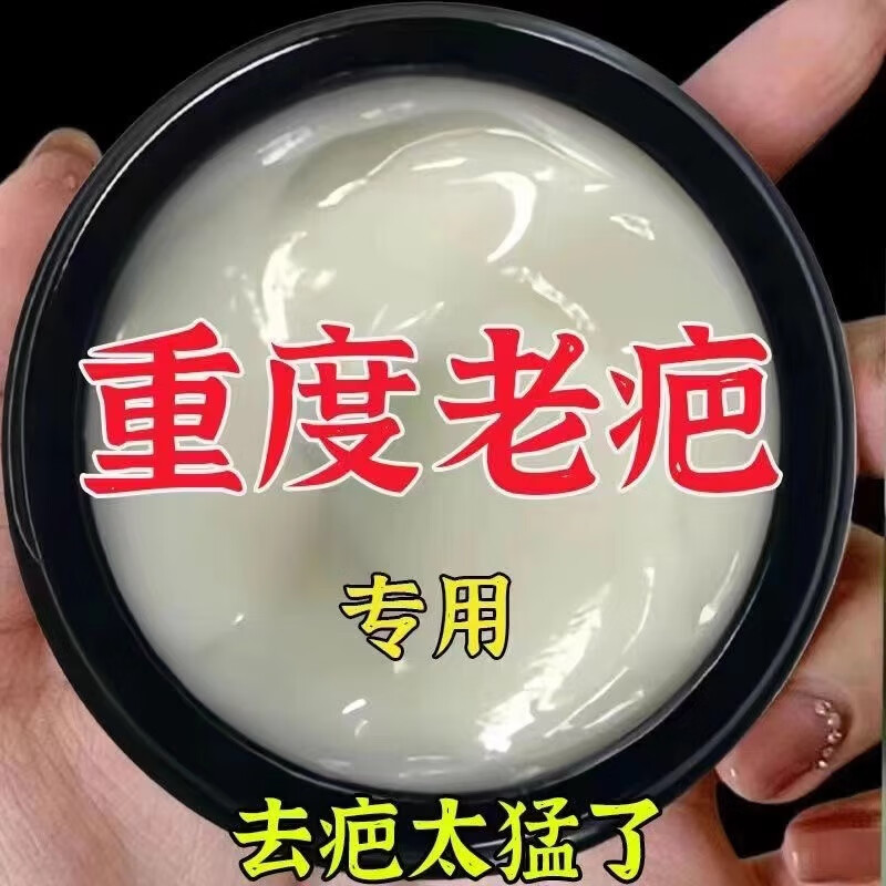 【香港中西薬邺】正品无痕修复淡色素净肤膏烧伤凹凸疤祛痘坑痘印 买3送2【祛20年中度面积疤痕】