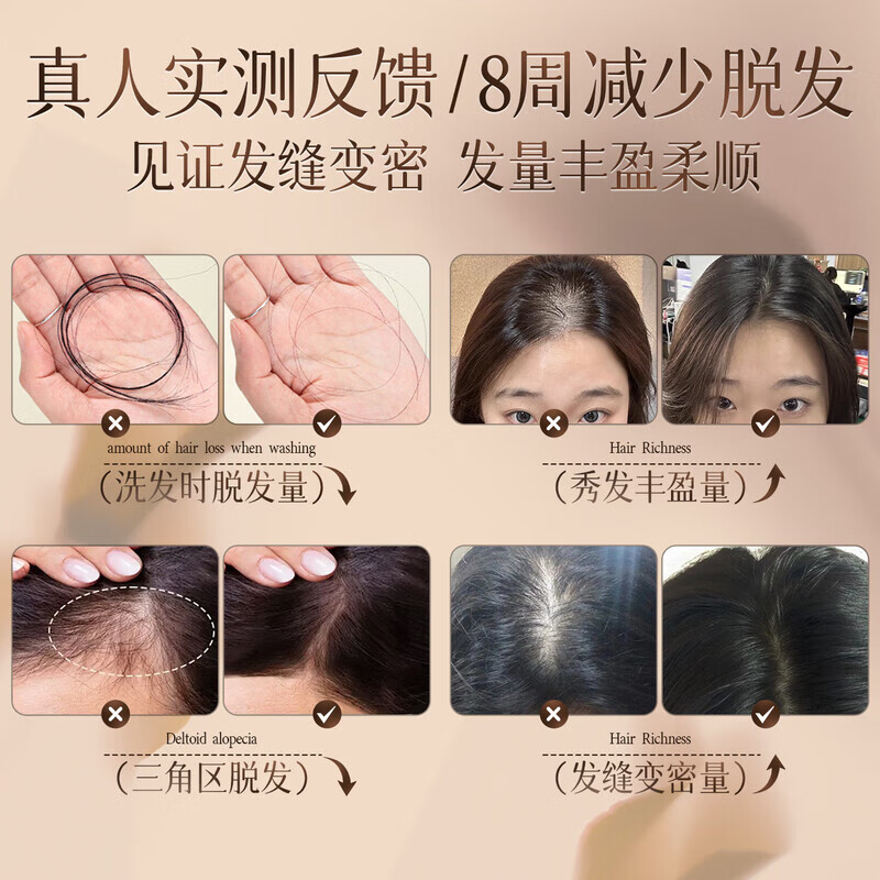 三个魔发匠防脱生姜洗发水500g男士侧柏叶去屑止痒育固发育发洗发露头膏第1 防脱 500ml*1瓶 生姜洗发水