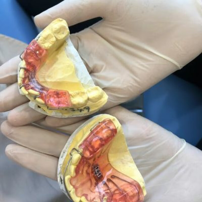 同款定制矫治器牙齿tb器导下颌向用于下巴后缩小下巴 同款定制矫治器