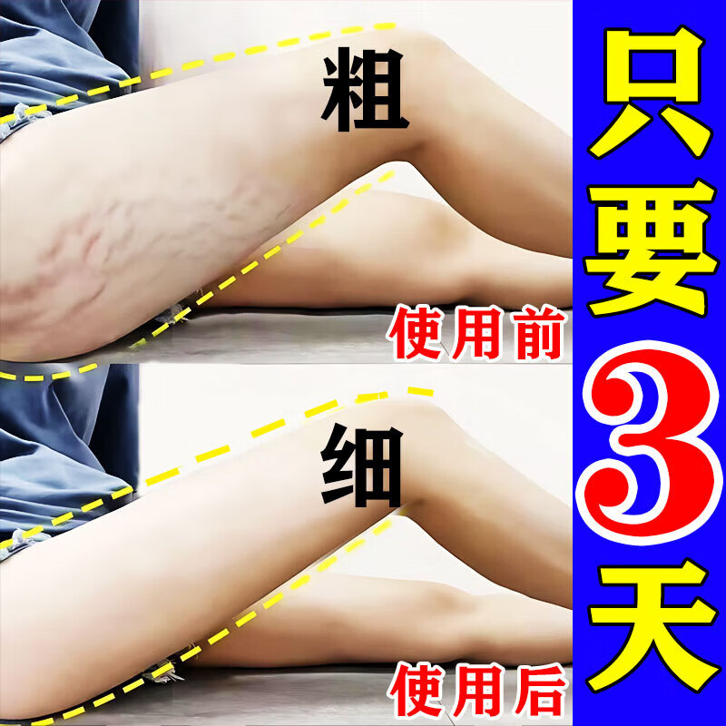 南京同仁堂美腿瘦腿神器大腿小腿粗腿减大象腿根部消除脂肪肌肉燃脂贴  买二赠一