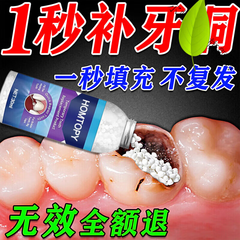 尔蝶牙洞填补膏补牙材料树脂自己在家蛀牙龋齿修复假牙粘合剂 瓶装