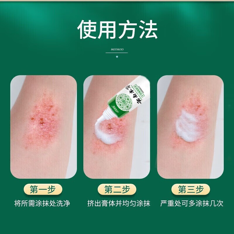 云南本草寓福堂抑菌膏草本软膏止痒阴囊潮湿手足脱皮小水泡牛皮膏 三支装抑菌乳膏