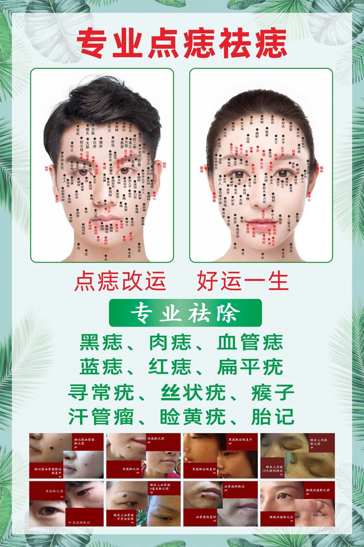 海报男女面痣图祛痣图片脸部取痣面部开运面相广告宣传挂图 点痣祛痣
