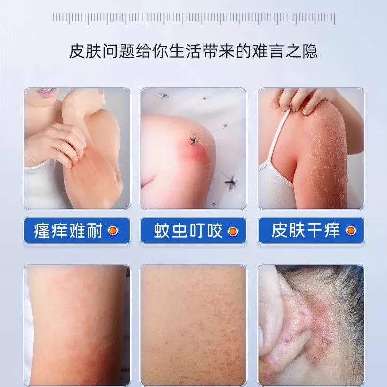 【日本炉甘石】特效皮肤瘙痒止痒洗剂洗澡皂沐浴全身体适用天然 买5送5【重度止痒】