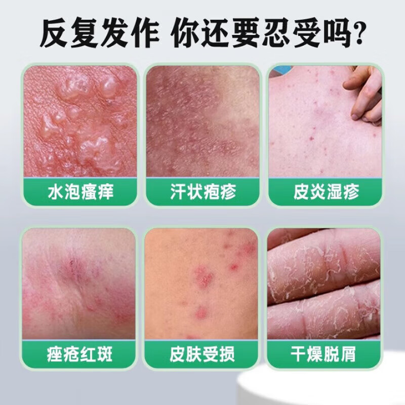 仲先医生医用皮肤液体敷料医用聚乙二醇护创敷料湿疹止痒膏丝状疣扁平疣 [2盒]轻度装