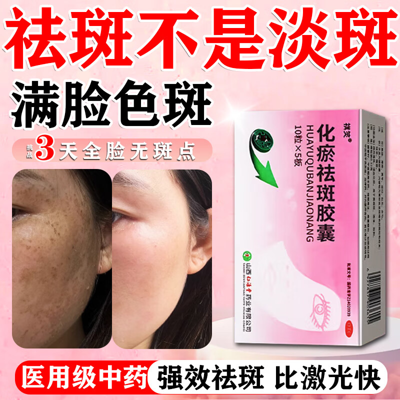 祛斑內(nèi)調(diào)中藥 黃褐斑雀斑老年斑肝斑日曬斑點蝴蝶斑淡斑成人專用水藥化瘀祛斑膠囊【第一頁名正品視覺特效】 3盒【黃褐斑日曬斑老年斑各種斑】