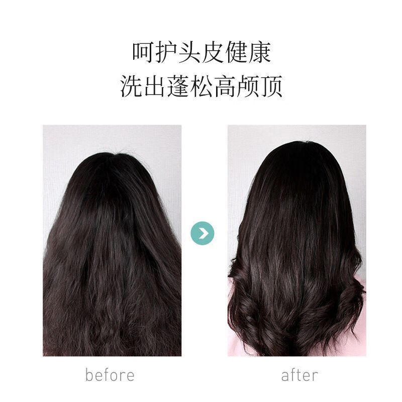 科丽尼舒缓头皮洗发水350ml洗头水控油去屑毛囊去油修护头皮男女 1瓶