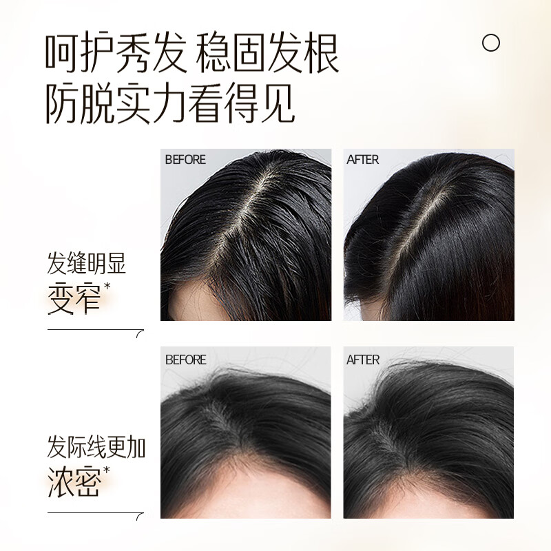 养元青洗发水控油强韧防掉发头皮护理护发精华强根健发洗发露长发 蓬松强韧金葫芦210ml