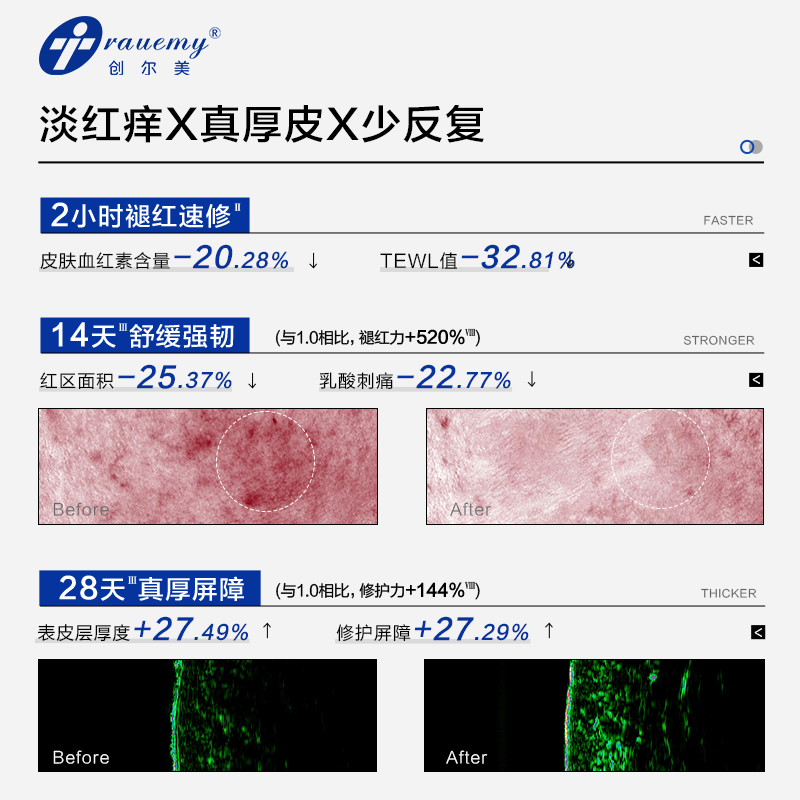 创尔美【新品上市】创尔美二代胶原多效修护乳舒缓清爽滋润敏感肌送女友 【超值囤货装】屏障修护乳250g