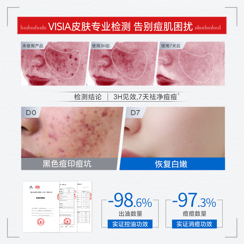 每珀壬二酸20%凝胶乳霜祛痘膏淡痘印黑头闭口粉刺医用15%升级浓度 1支【20%祛痘壬二酸30g】拍2发3