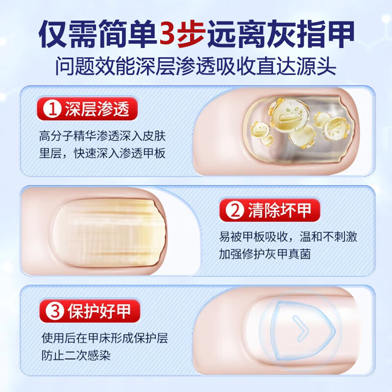 重度灰指甲100%特效专用的药特殊效专用抑菌液灰甲净套装 一盒【特效套装】1-2个灰甲选 灰指甲100%特效专用的药第一名