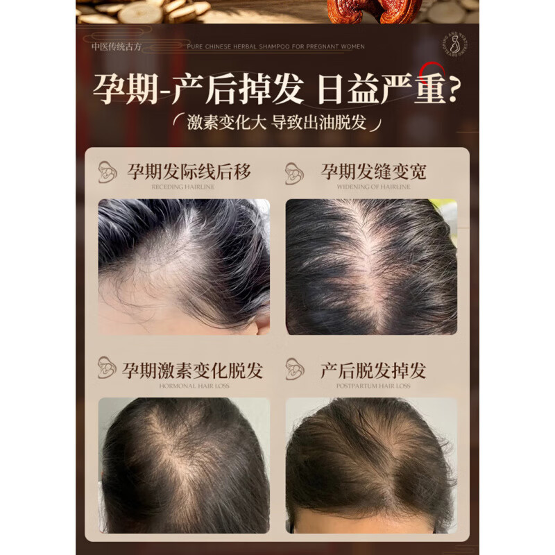 梦若羽防脱发密发增发女士专用洗发水柏叶生姜产后脱发孕妇防断育发
一瓶装 【0硅油|弱酸性配方】纯中药洗发