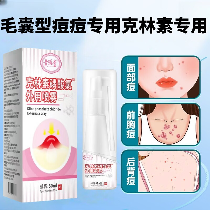 黄辅堂克林素磷酸霉喷雾毛囊型痘痘专用脸上面部痘胸前痘背部痘头部痤疮 祛痘抑菌痤疮专用青少年【8瓶*50ml】巩固装