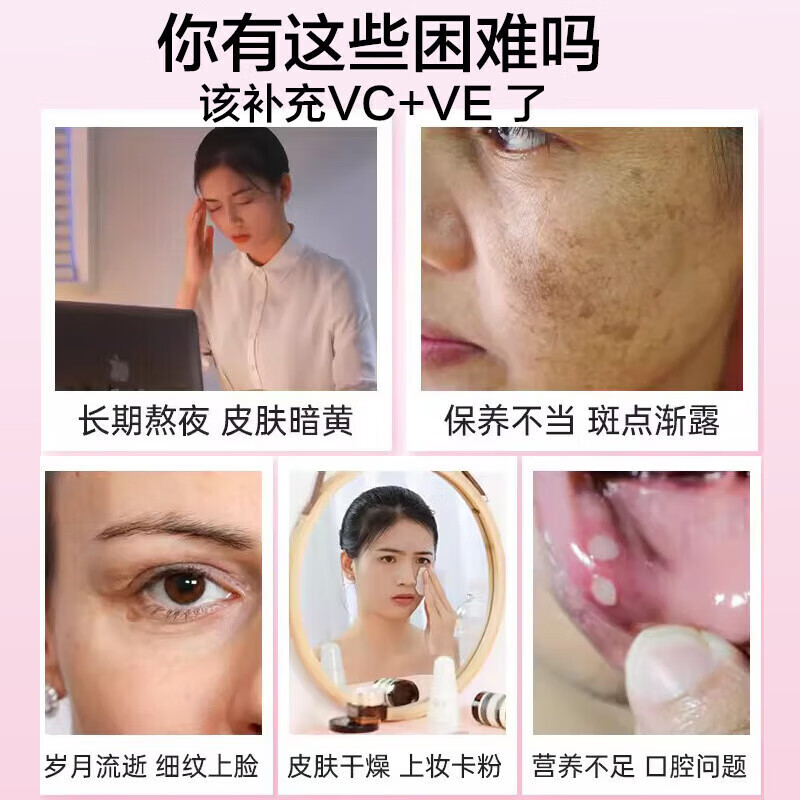 朕皇北京同仁堂美白维生素c维生素e烟酰胺咀嚼片vc内服正品 【1盒体验装】60片/盒