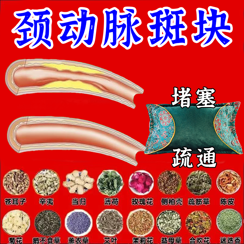 颈动脉斑块狭窄供血不足堵塞缺血硬化头晕脑腔梗塞专用中药枕头 颈动脉斑块专用 【高级升级功效】