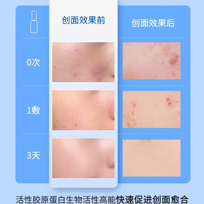 医度森医用重组胶原蛋白修复敷料医用冷敷贴敏感肌护理创面愈合 【十盒装 到手50片】回头客常买【日常维稳+修复】
