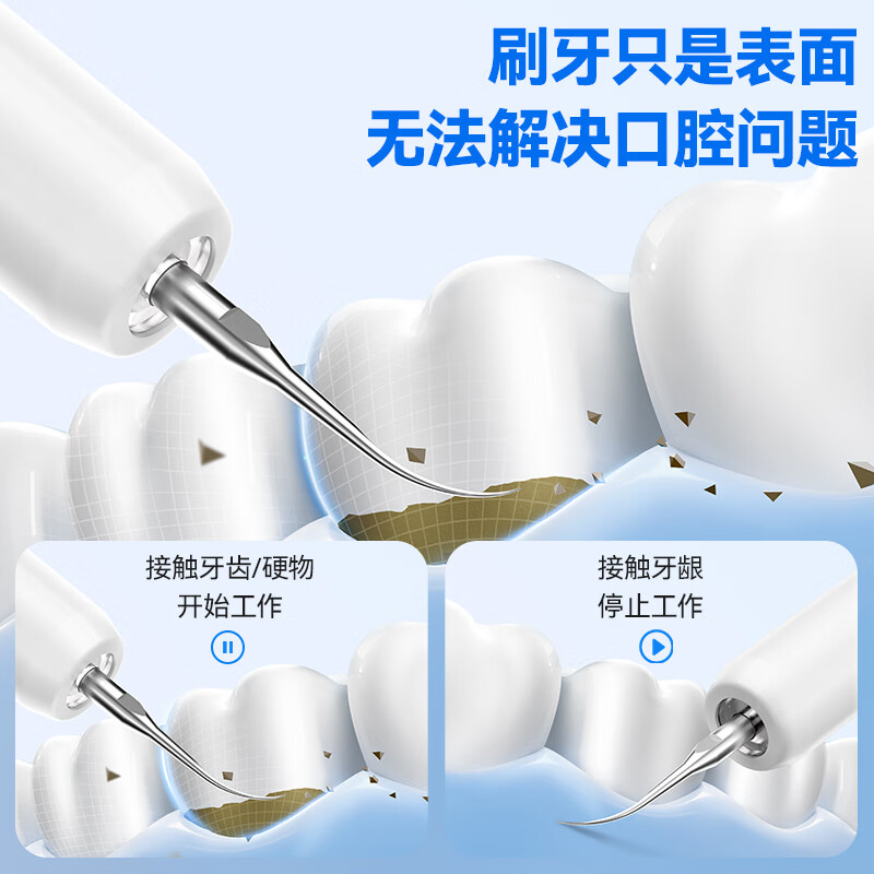 OES超声波电动洁牙器专业洗牙器清除黄牙石牙菌斑牙垢结石去除器去烟渍茶渍污垢神器工具家用节日礼物 【双明星推荐】900W超声波+5档+断电保护+礼品 老人父母亲爸爸妈妈实用生日礼物送长辈