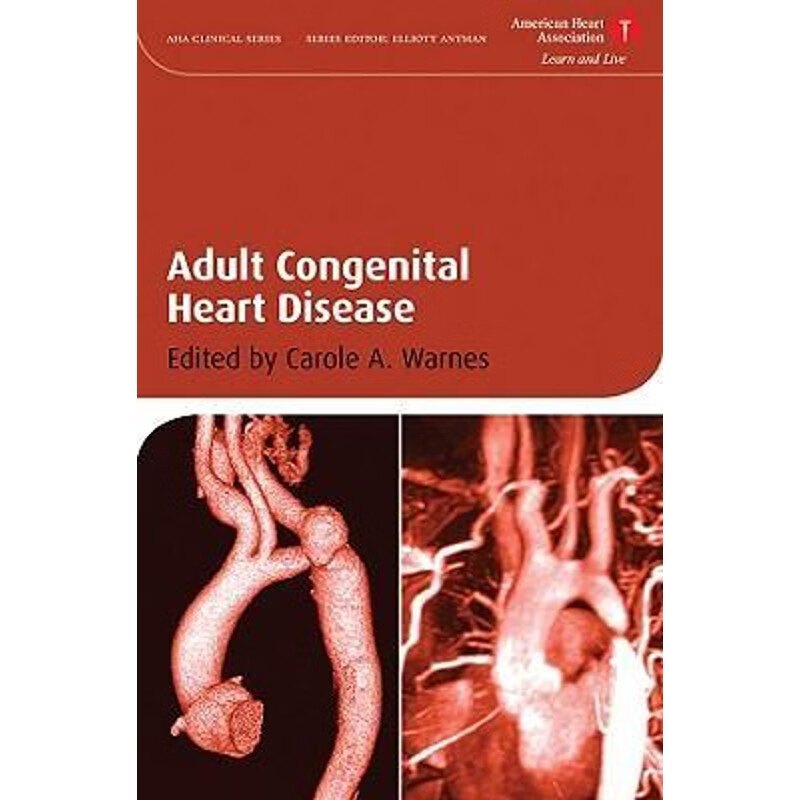 按需印刷 adult congenital heart disease