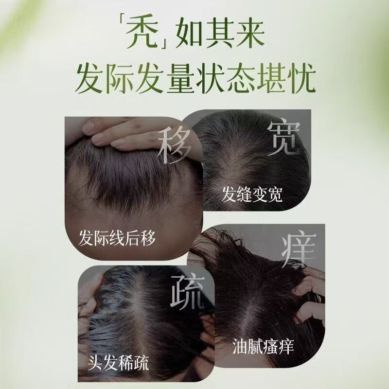 柚冰清柚冰清洗发水草本人参滋养控油去屑韧发防断发丝蓬松强健正品 【重度掉发】洗发水370g*3瓶