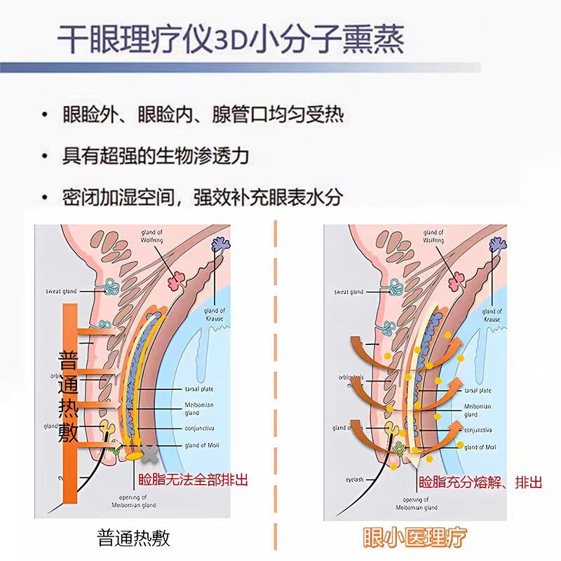 眼小二眼小医干眼理疗仪熏蒸热敷补水缓解干眼疏通睑板腺堵塞院线同款 白色 YXY_0101