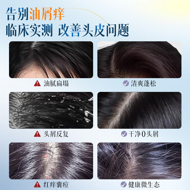 维特丝洗发水控油去屑止痒蓬松男女士持久留香无硅油清洁洗头膏洗发露 【爆卖推荐】控油去屑洗发水