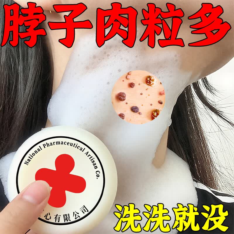 示博士【国药匠心去疣痣皂】全身小肉粒扁平尤丝状尤疣瘊抑菌祛疣香皂 【买2送1】标准升级装