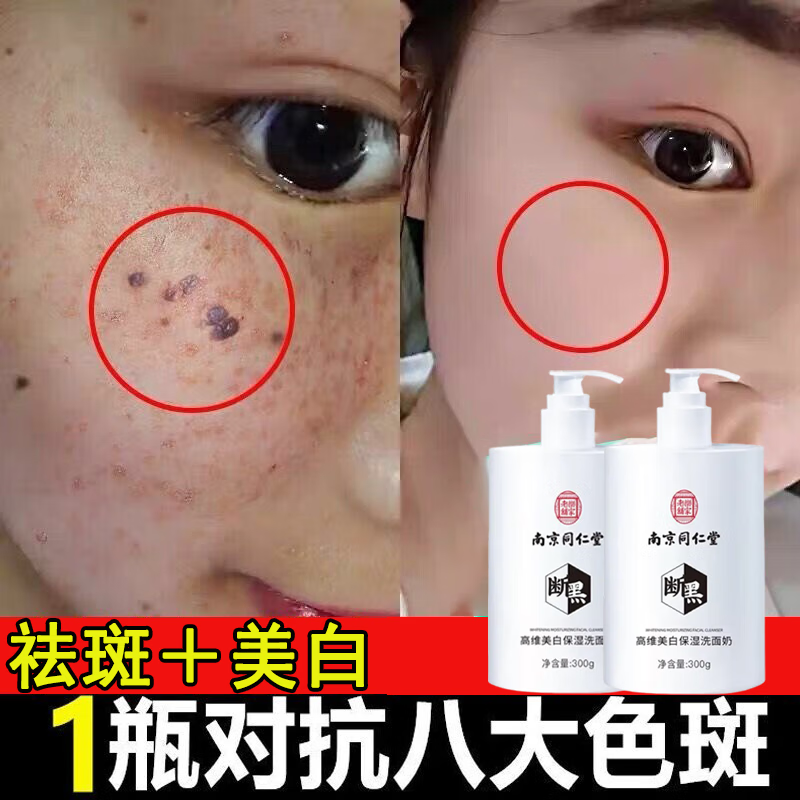 同仁堂断黑美白祛斑洗面奶男女士控油提亮改善暗沉深层清洁毛孔洁面乳 两瓶周期装[老客户复购] 京东折扣/优惠券