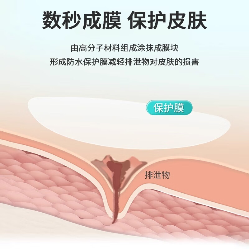 护士同学12020造口皮肤保护剂造口袋黏胶去除剂造口防漏圈造口护理四件套 造口皮肤保护剂12020液体敷料（ 50ml月度）