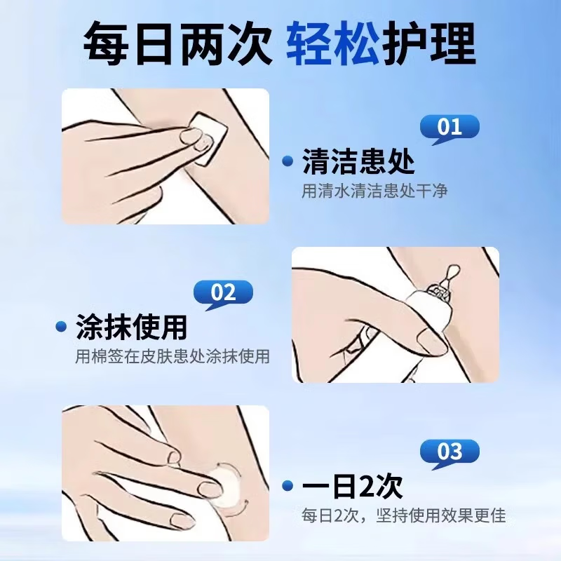 葵花祛疣凝胶去除疣体药膏丝状疣丝状疣脖子颈部扁平疣疣体脱落膏专用 特效一盒装【疣猴灵膏】