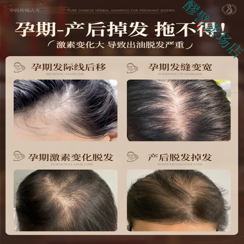 梦若羽防脱发密发增发女士专用洗发水柏叶生姜产后脱发孕妇防断育发
一瓶装 【0硅油|弱酸性配方】纯中药洗发