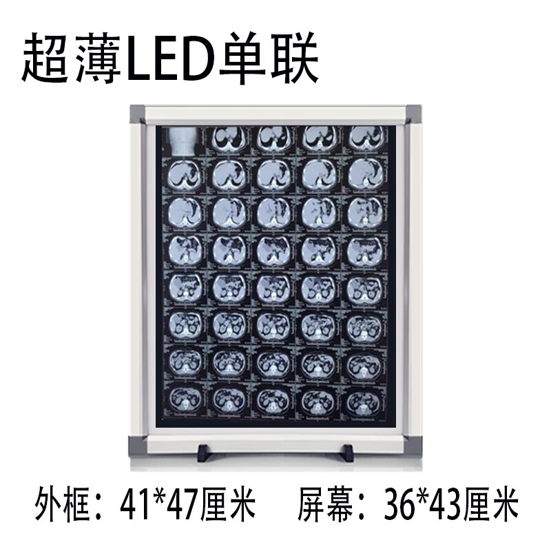 X光閱片燈CT核磁骨科看片燈ed觀片燈箱牙科雙三聯(lián)觀片燈 高品質(zhì)ed單聯(lián)[免維護]掛鉤