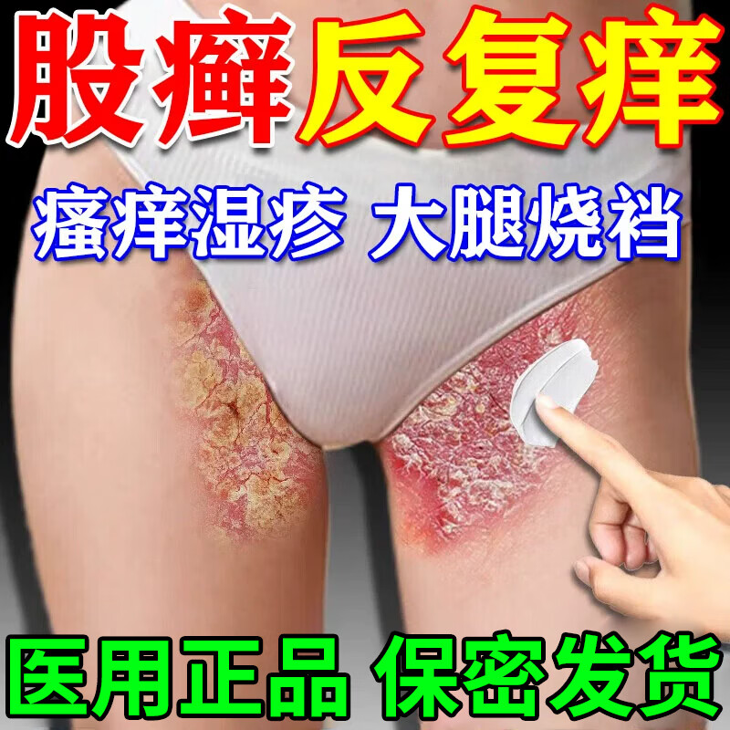 修正股癣膏大腿内侧真菌感染腹股沟股癣烧裆私处潮湿止痒皮肤抑菌凝胶 单盒装