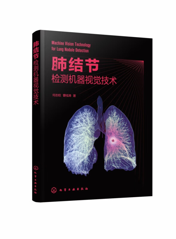 肺结节检测机器视觉技术