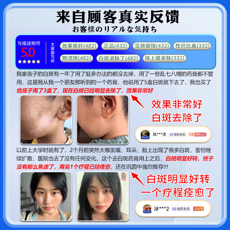 岩井昃弘进口白癜风药膏外用促进黑色素生长修复膏白癜风遮盖液专用神器 买3送2【永久无白斑】贝兰洁 白癜风保健膏日本补骨脂酊消i白