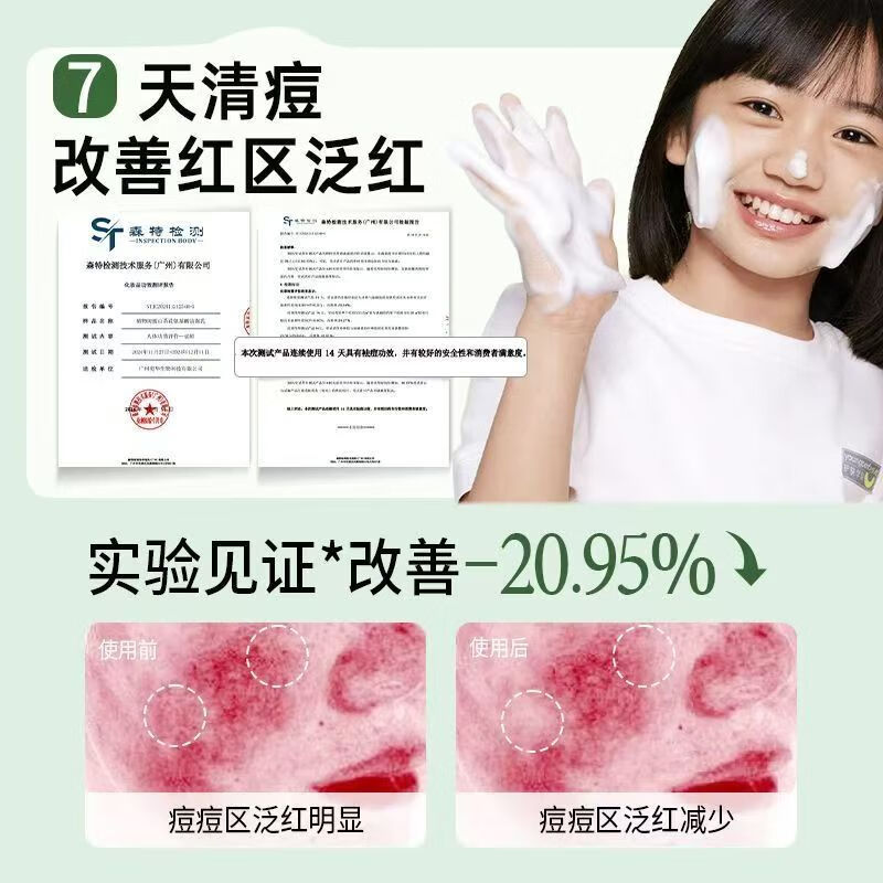植物闺蜜 PLANT FRIEND青少年儿童温和氨基酸洗面奶清洁面乳男女孩控油祛痘6-12岁护肤品 【除螨祛痘】青少年洁面乳2支
