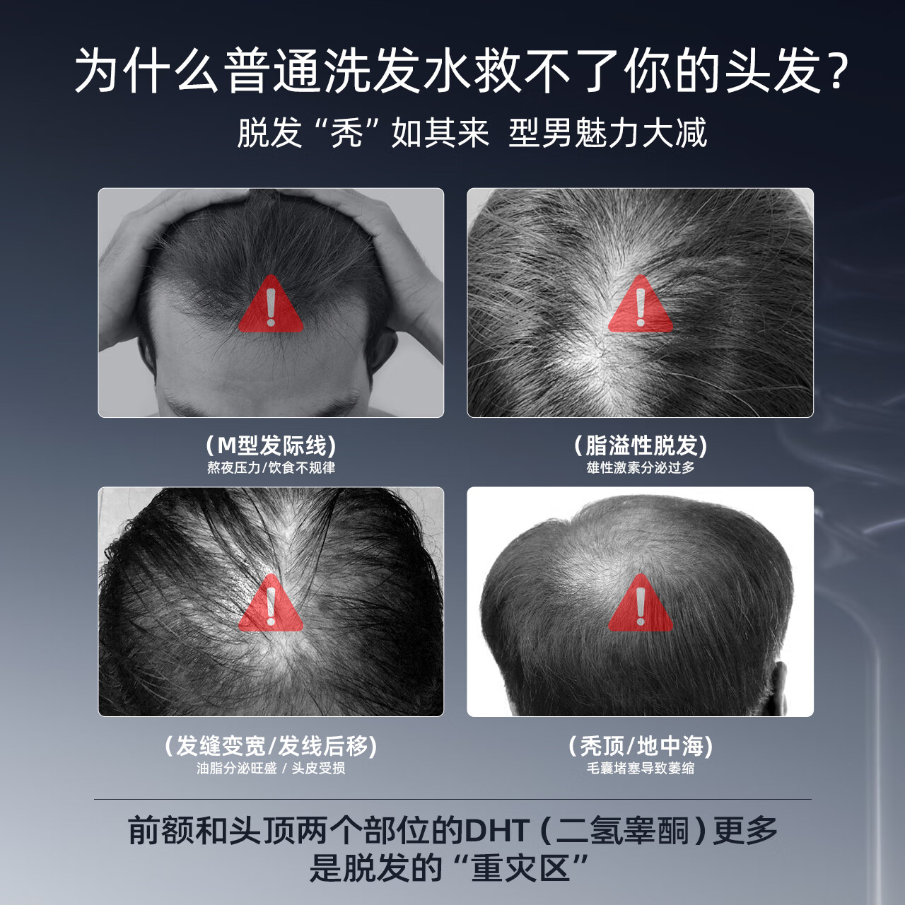 三个魔发匠可比落防脱洗发水生姜固发侧柏叶育控油去屑洗头膏露男女士第1 可比落防脱 400ml*1瓶 男士专研