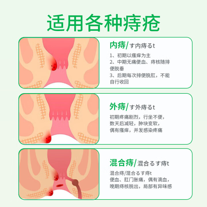 冈朴制药日本痔疮膏去肉球痔疮凝胶庤疮专用栓卡波姆内外混合痣软膏 1盒