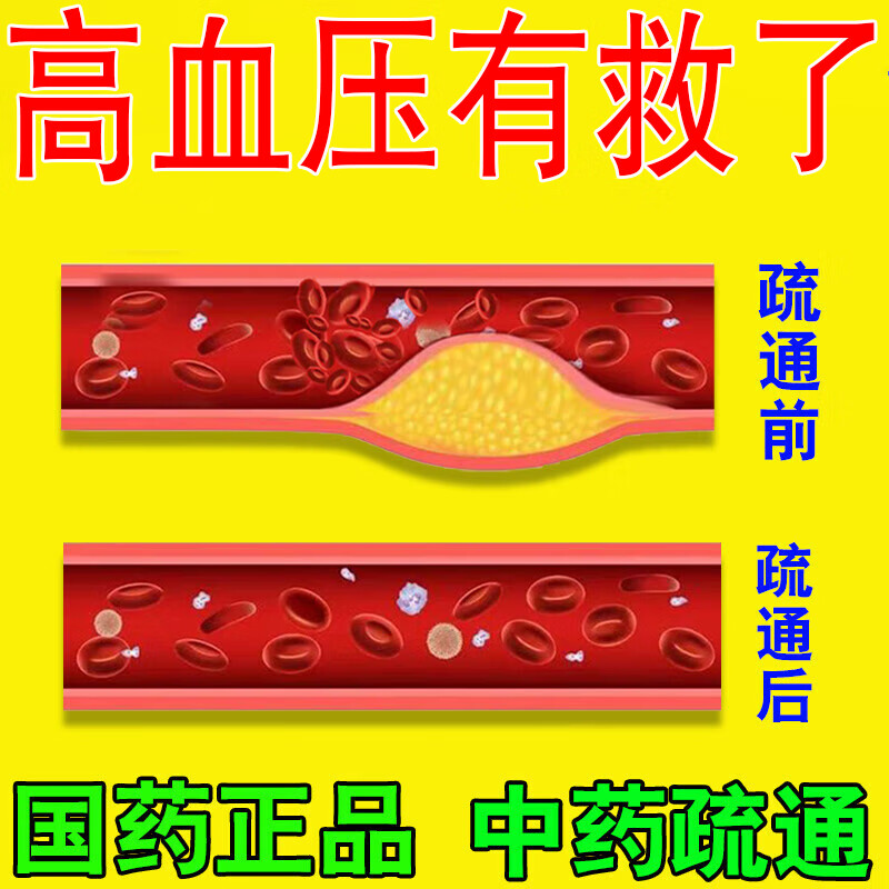 降压枕头改善身体降血压稳压安神助眠头晕头疼高血压专用中药枕头 高级【治高血压】 100%治好