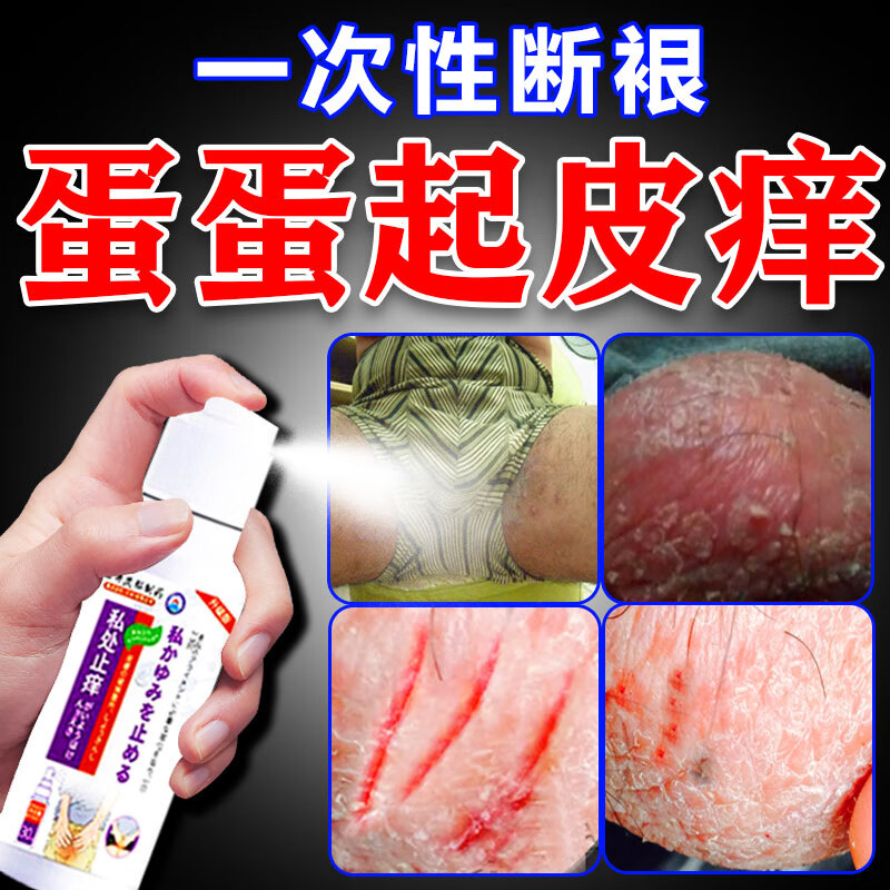 阴囊脱皮痒干燥起鳞片白花花皮屑男性下体潮湿疹蛋蛋止痒去i根药 特效