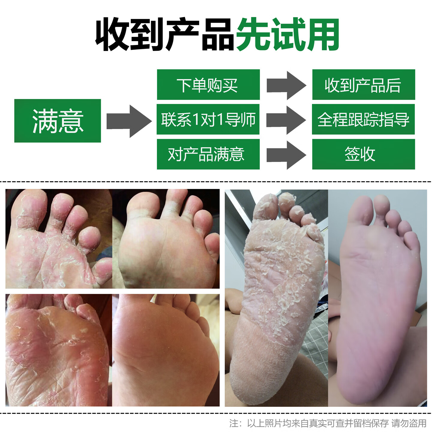 润芷堂脚气泡脚【泡1次】洁丫本草 足浴包脱皮水泡脚痒烂脚丫汗脚臭喷剂 轻度中度用1次