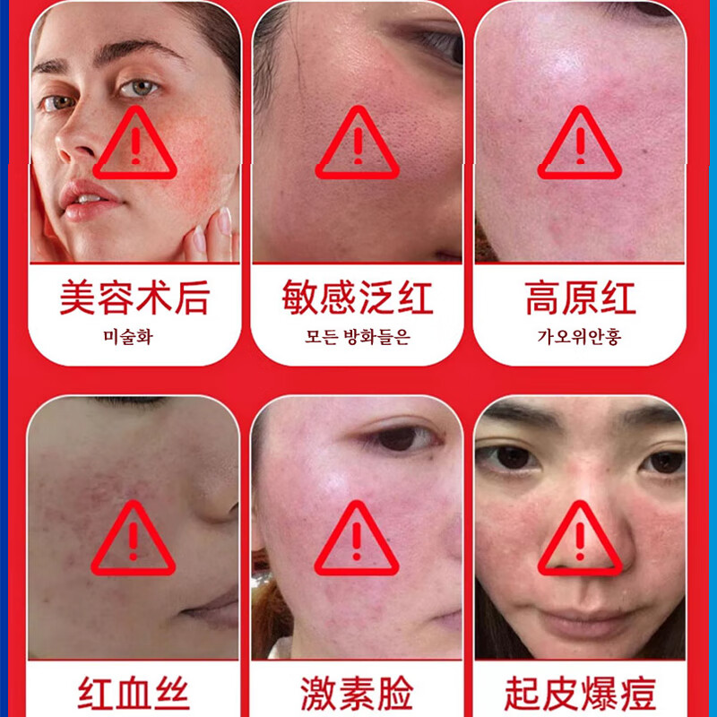 示博士祛红血丝精华液高原红激素脸修复敏感肌鼻子红血丝男女通用 3盒强效装【改善轻度泛红】