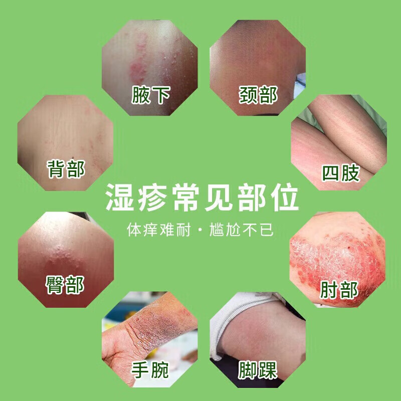 [丽珠]荆肤止痒颗粒 3g*10袋 1盒装 荆肤止痒颗粒荨麻疹专用国药正品止痒抑菌皮肤瘙痒身体痒荨麻疹湿疹进口服止痒去过敏 荨麻疹皮肤瘙痒止痒用药